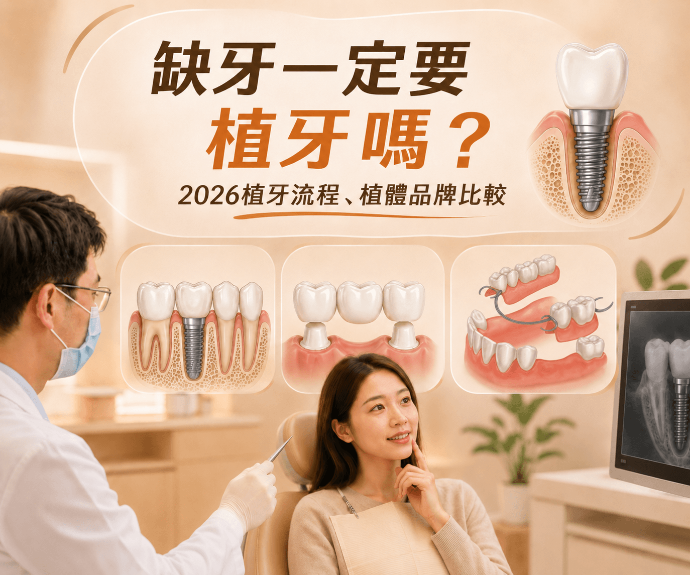 缺牙一定要植牙嗎？2026醫師推薦的植牙流程、植體品牌比較