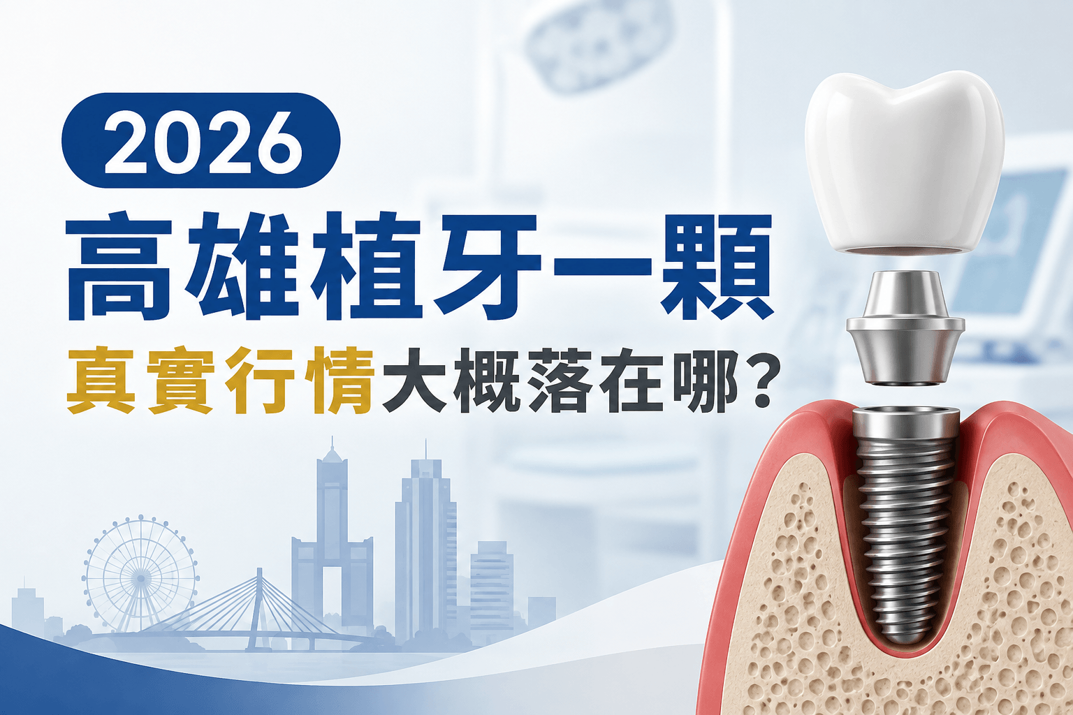 2026高雄植牙推薦完整攻略：一顆真實費用、怎麼選才不踩雷、流程與長期價值一次講清楚